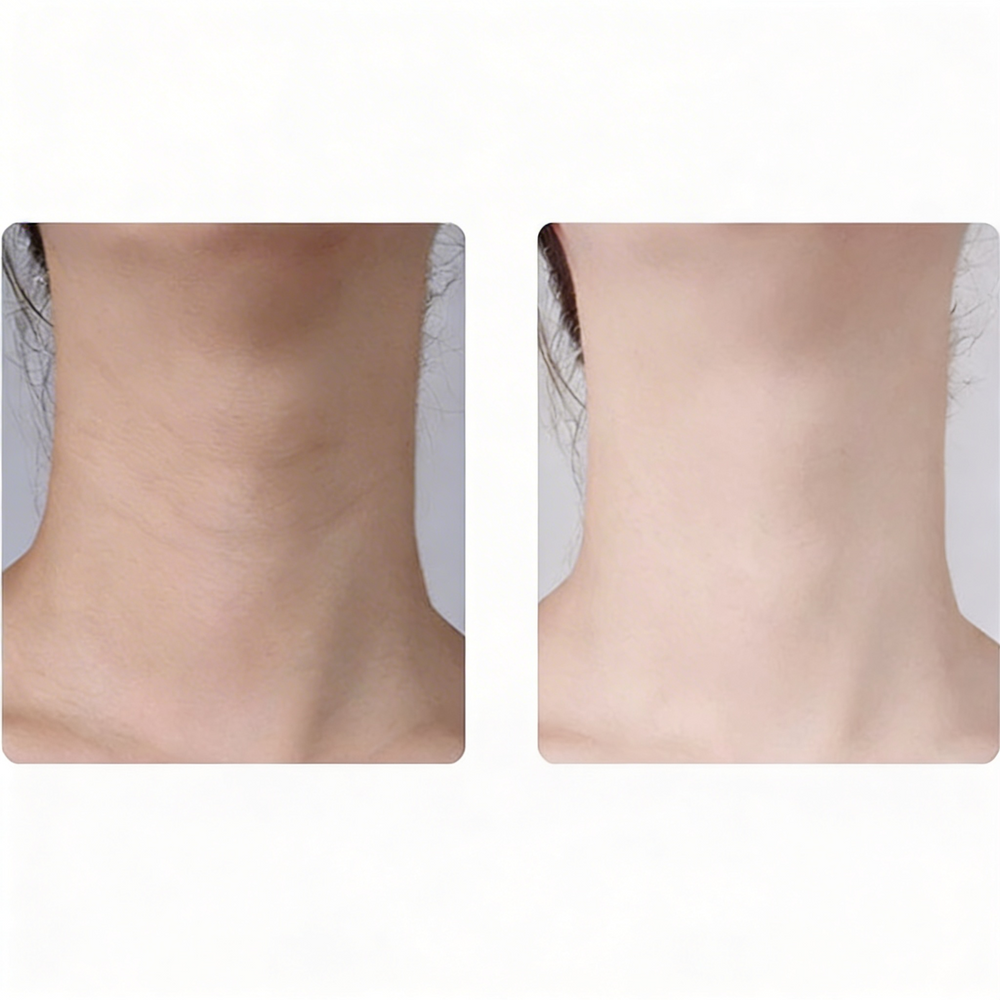 beauty neck device review