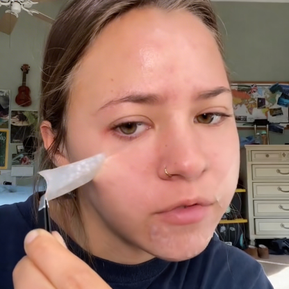 Hydrocolloid Roll - Pimple & Acne Patch